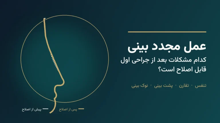 طرح گرافیکی نیم‌رخ بینی پیش و پس از اصلاح، با عنوان عمل مجدد بینی